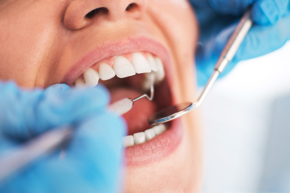 How Can I Improve My Dental Health?
