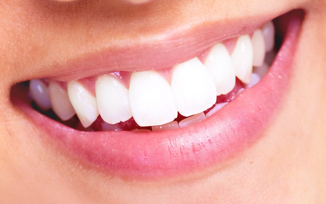 3 Good Reasons To Have Professionally Whitened Teeth