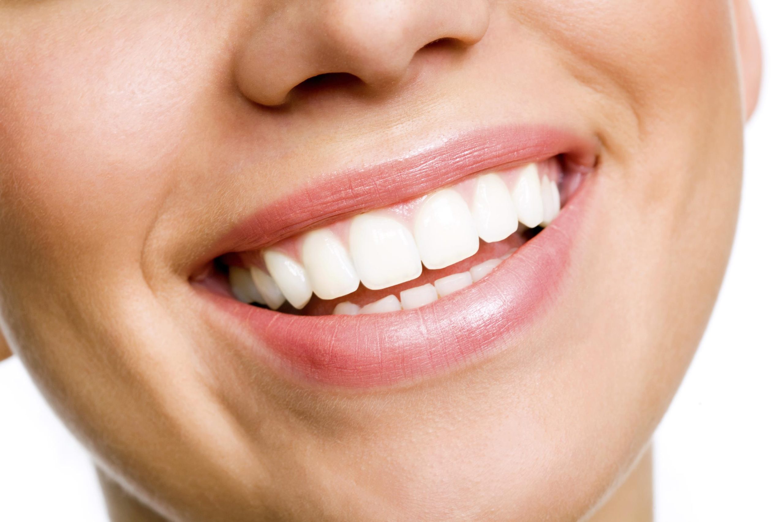 Teeth Whitening- FAQS