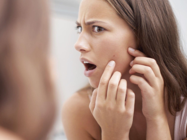 How to Manage Acne Issues with Some Best Solutions