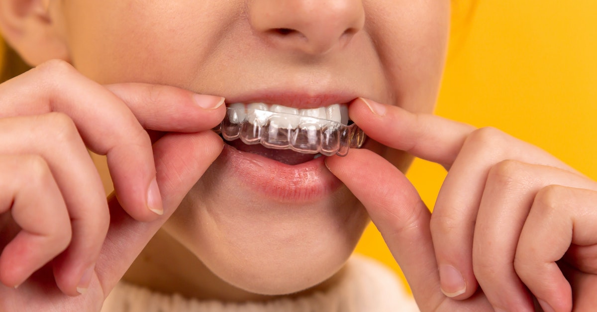Can Braces or Aligners Help for TMJ Disorders?