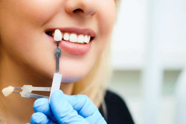 General Information about Cosmetic Dentistry